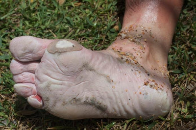 Foot Care: How to Take Care of Your Feet